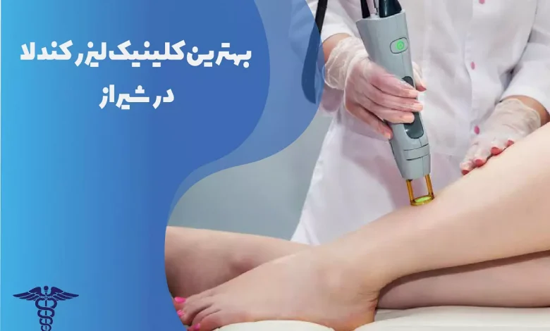 بهترین کلینیک لیزر کندلا در شیراز