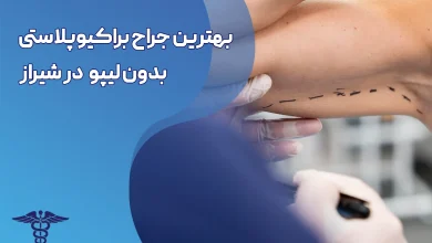 براکیوپلاستی بدون لیپو در شیراز
