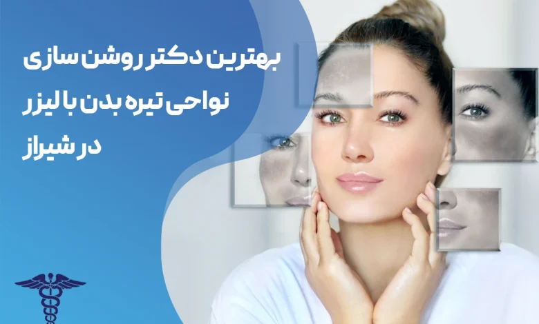 روشن سازی پوست تیره با لیزر