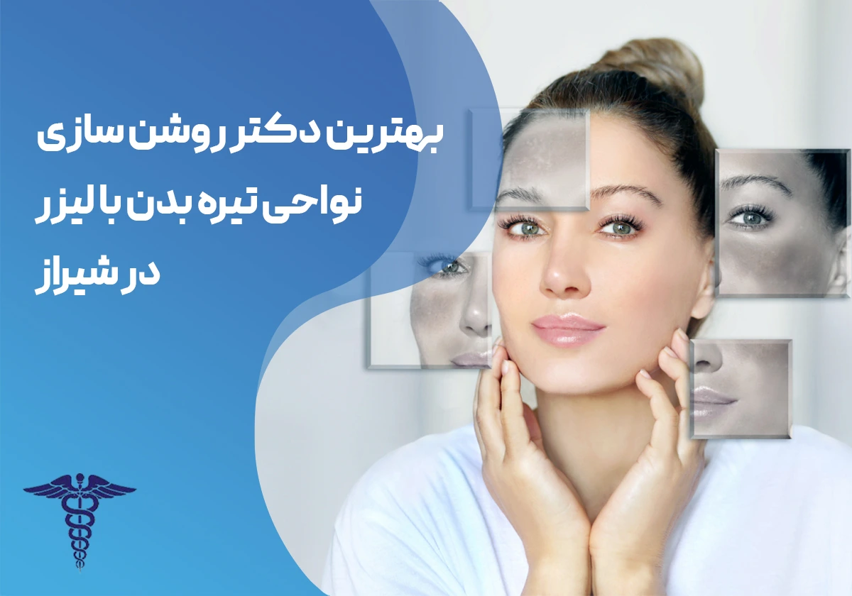 روشن سازی پوست تیره با لیزر