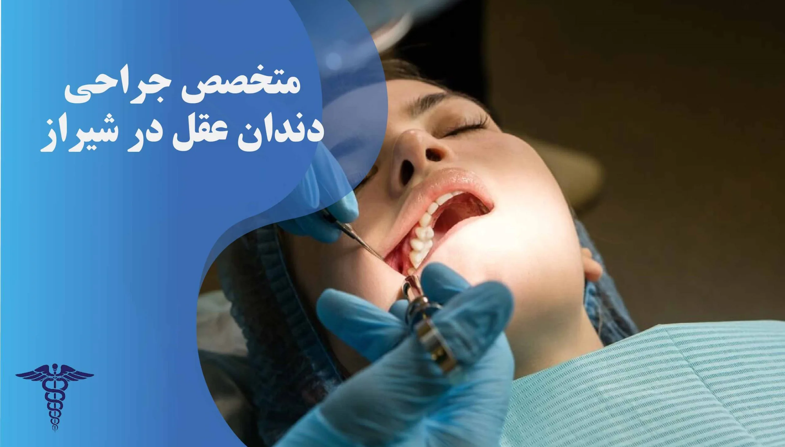 متخصص جراحی دندان عقل در شیراز