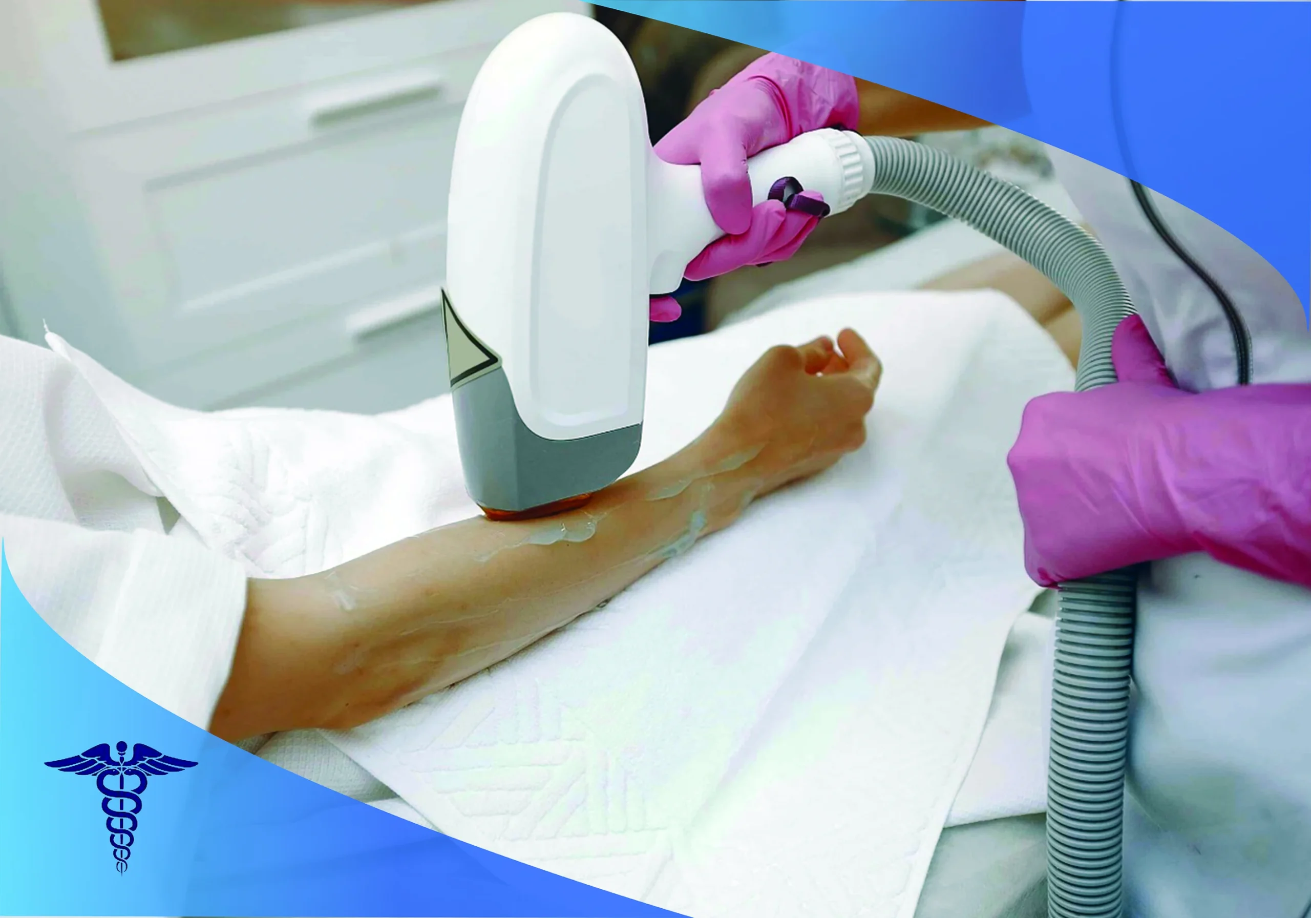 مراحل انجام لیزر سوپرانو تیتانیوم در شیراز