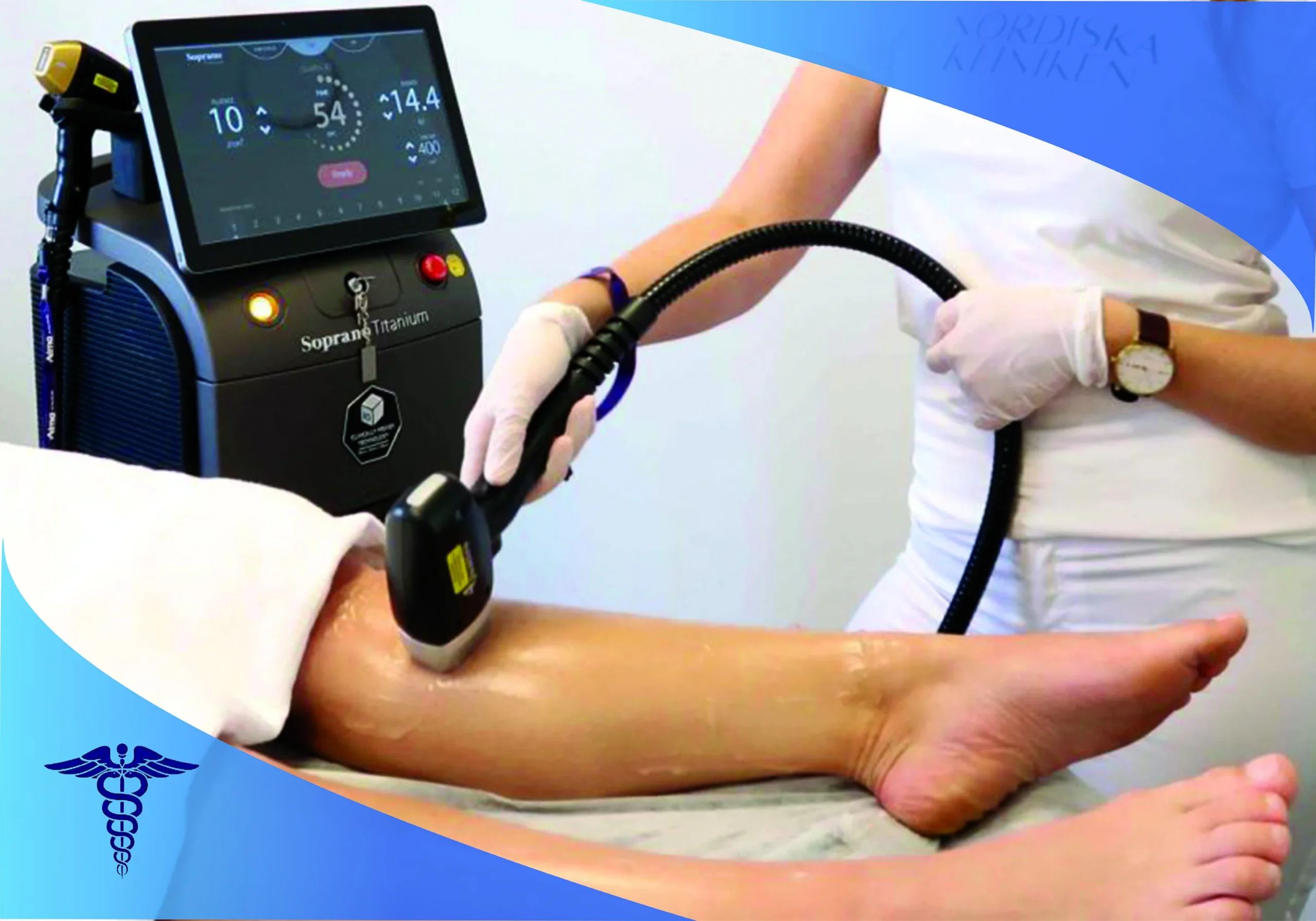 مراقبت های قبل از انجام لیزر سوپرانو تیتانیوم در شیراز