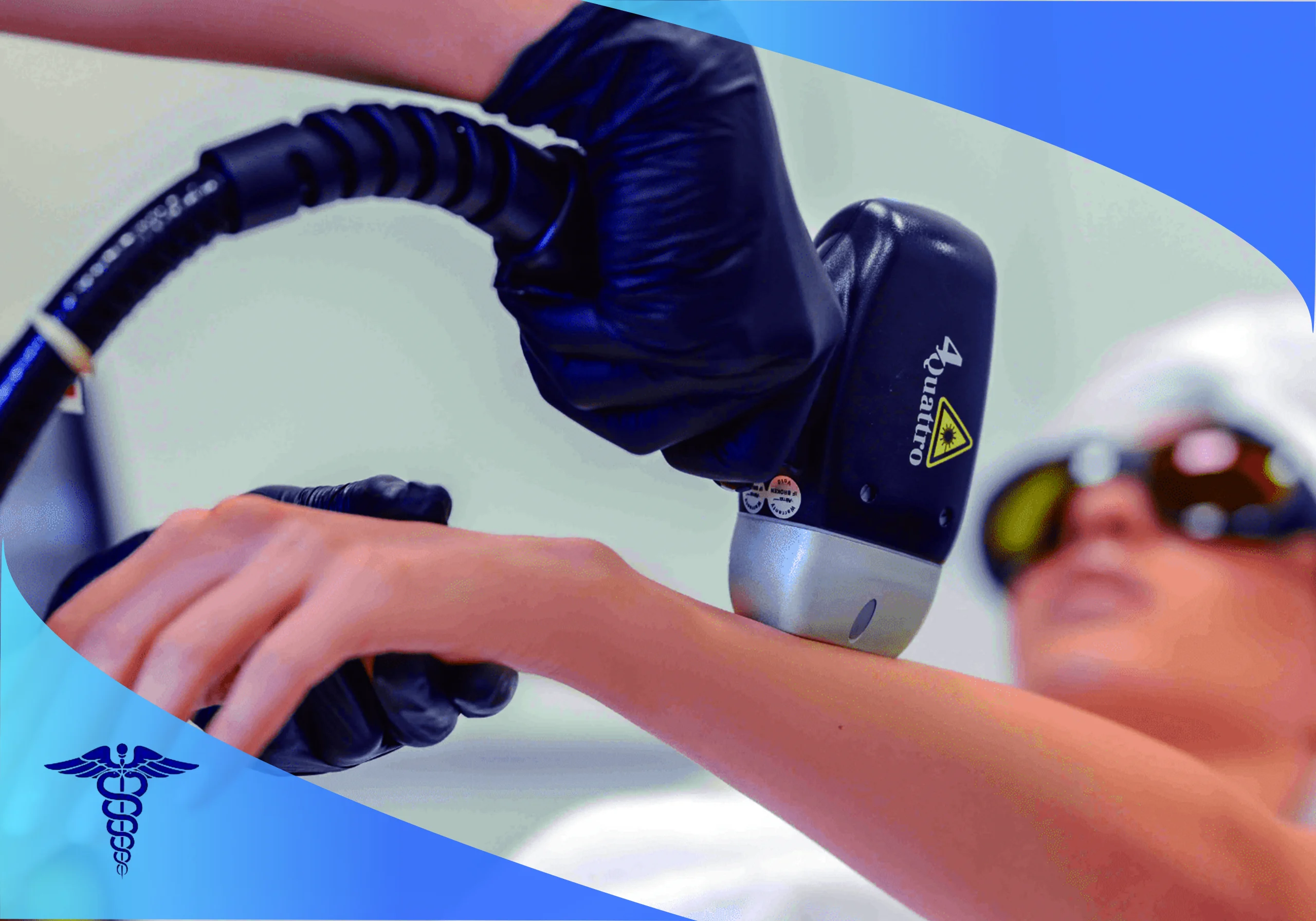 لیزر سوپرانو تیتانیوم در شیراز؛ پاسخ به سوالات متداول