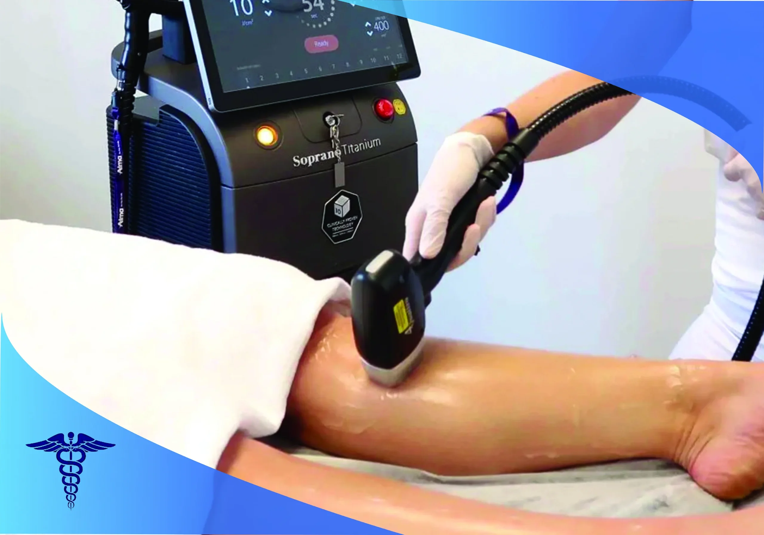 مکانیسم عملکرد لیزر سوپرانو تیتانیوم در شیراز