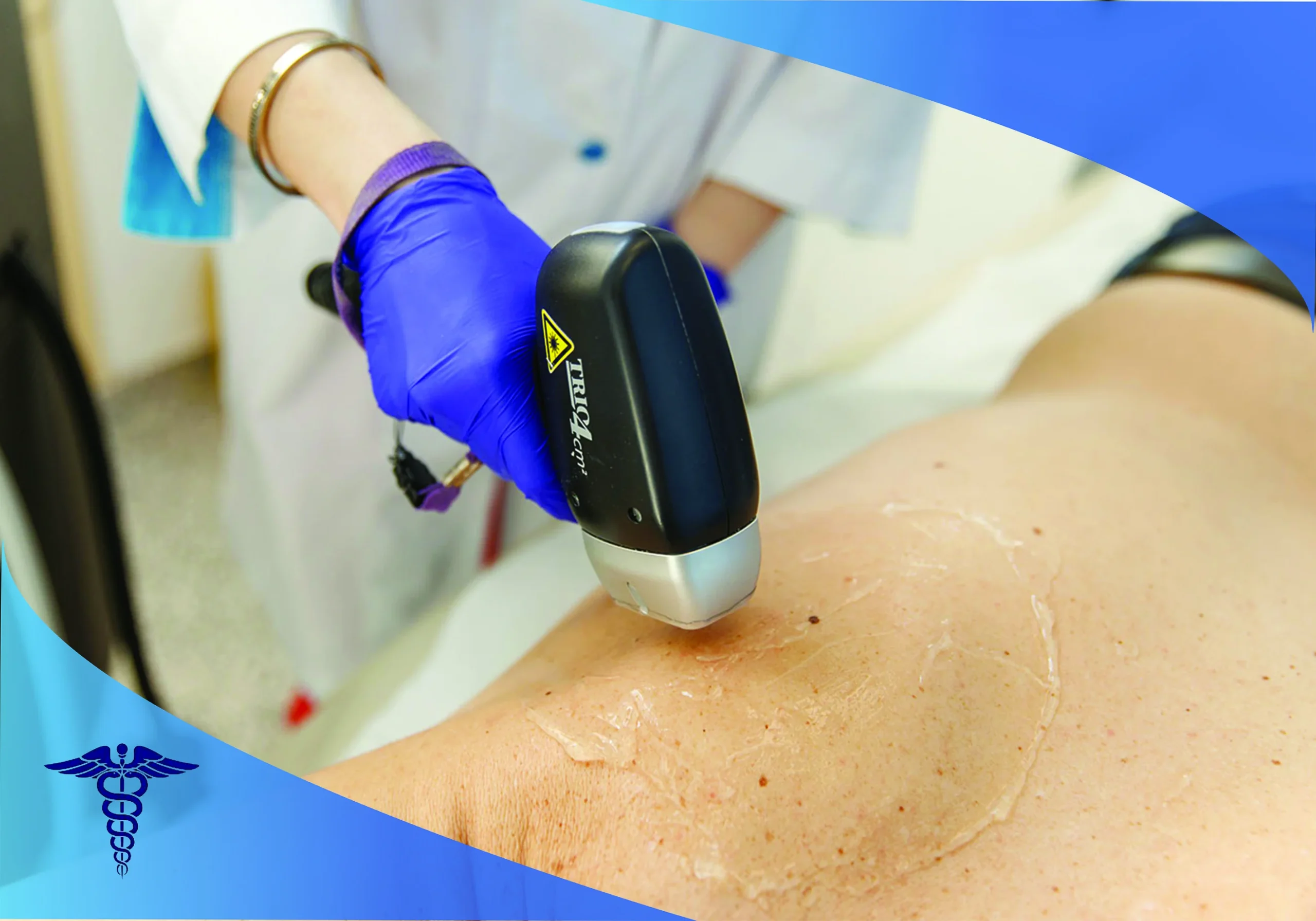 لیزر سوپرانو تیتانیوم در شیراز و انواع تیپ پوستی