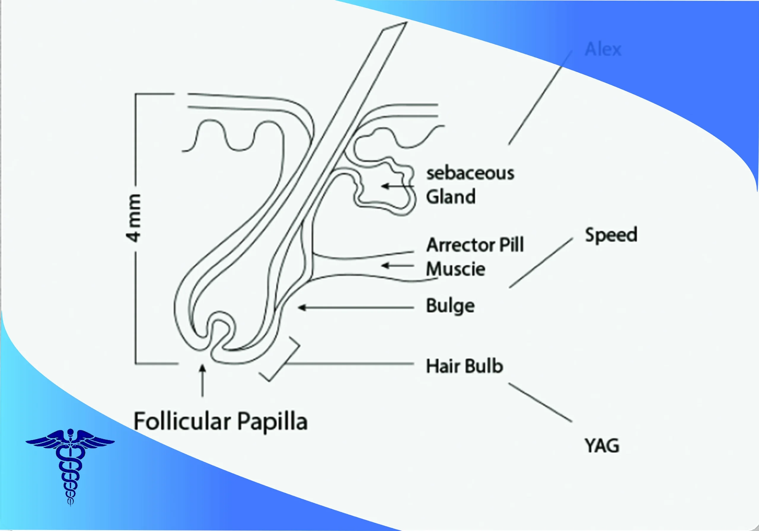 طول موج های لیزر سوپرانو تیتانیوم در شیراز