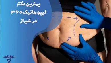 لیست بهترین دکتر لیپوماتیک 360 درجه در شیراز