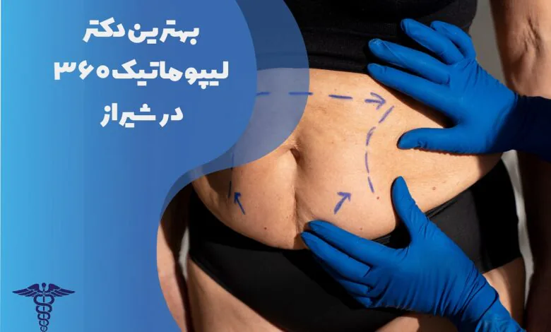 لیست بهترین دکتر لیپوماتیک 360 درجه در شیراز