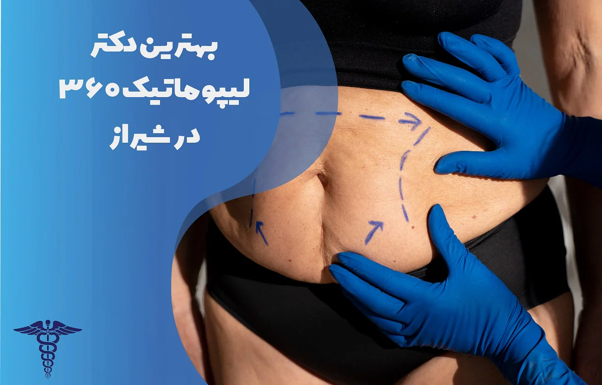 لیست بهترین دکتر لیپوماتیک 360 درجه در شیراز