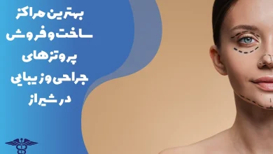 معرفی مراکز فروش پروتزهای جراحی و زیبایی در شیراز