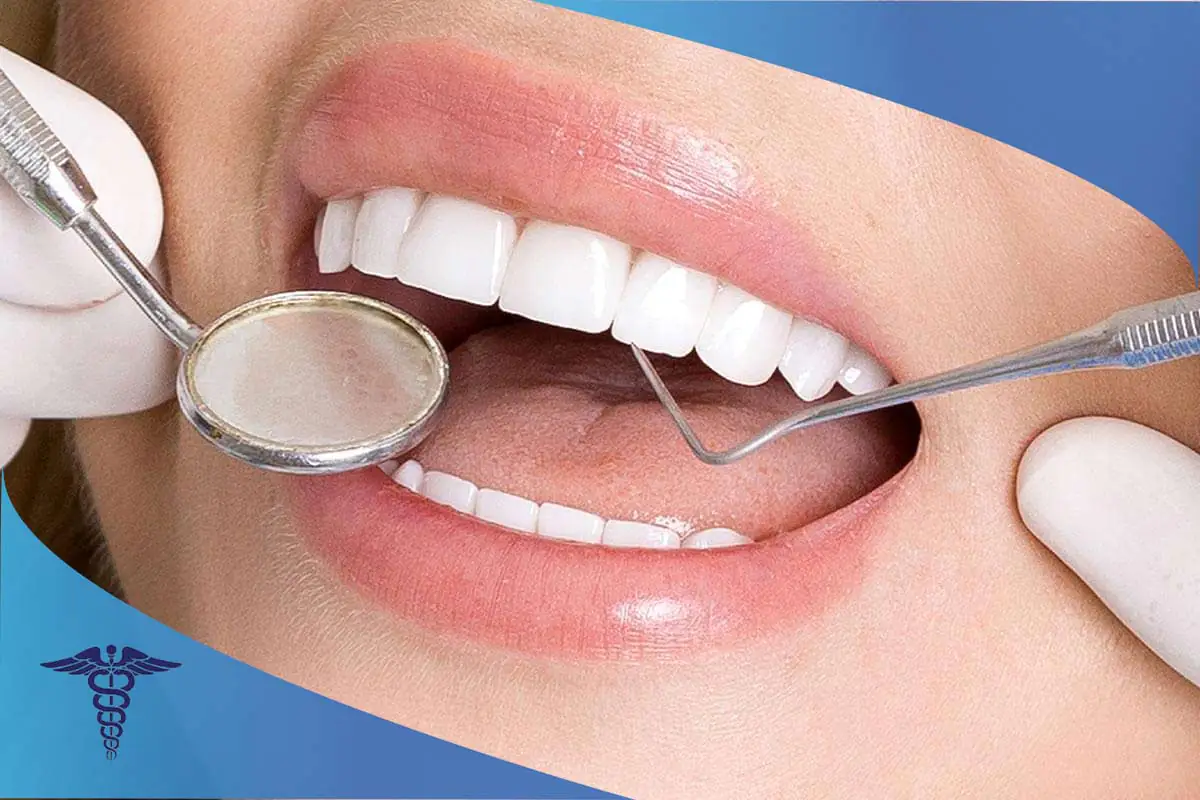 بهترین متخصص لمینت در شیراز