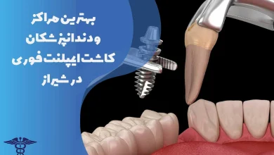 13 تا از مراکز کاشت ایمپلنت فوری در شیراز