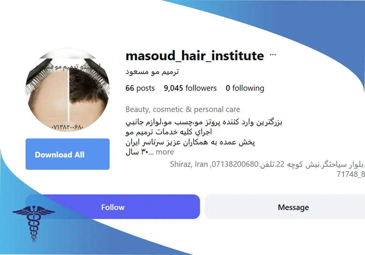 اینستاگرام پروتز مو مسعود شیراز
