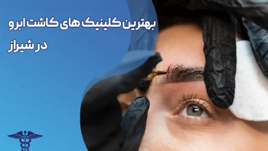 کاشت ابرو در شیراز