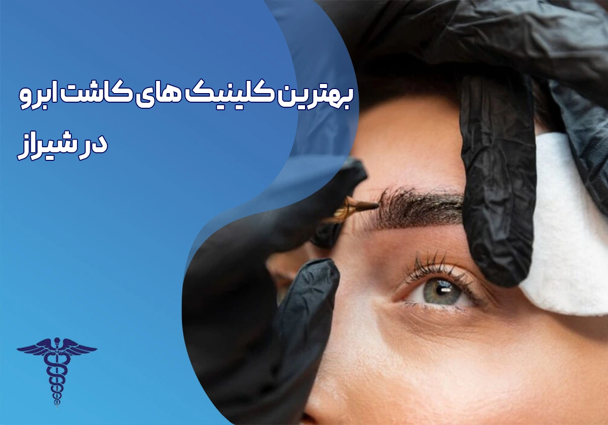 کاشت ابرو در شیراز