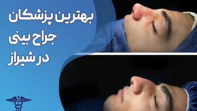 بهترین پزشکان جراح بینی در شیراز