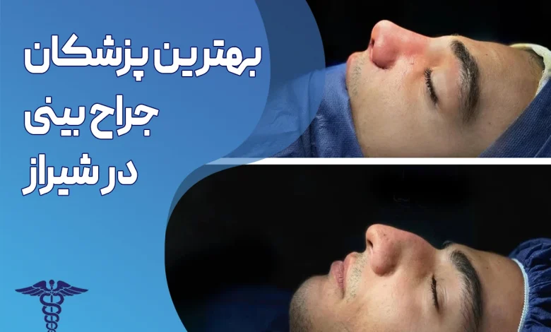 بهترین پزشکان جراح بینی در شیراز