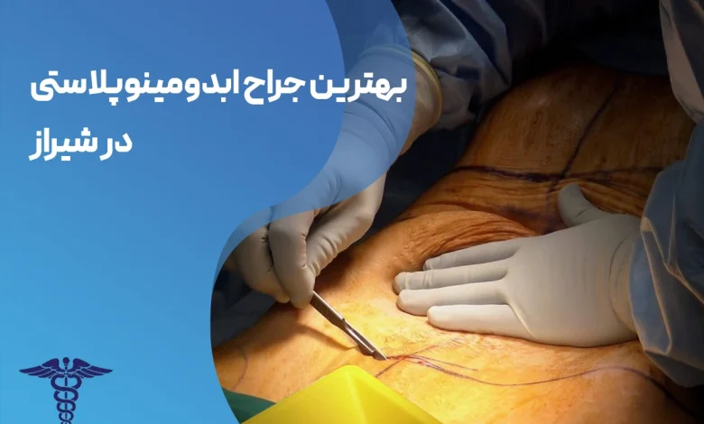 ابدومینوپلاستی در شیراز