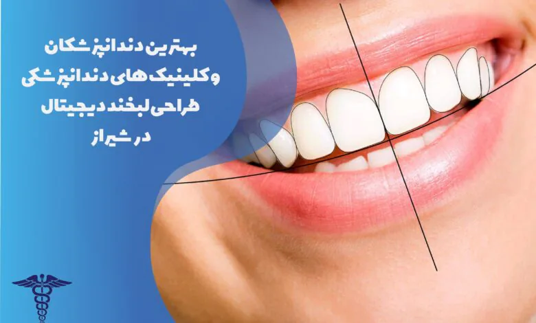 بهترین کلینیک ها و دندانپزشکان طراحی لبخند دیجیتال در شیراز
