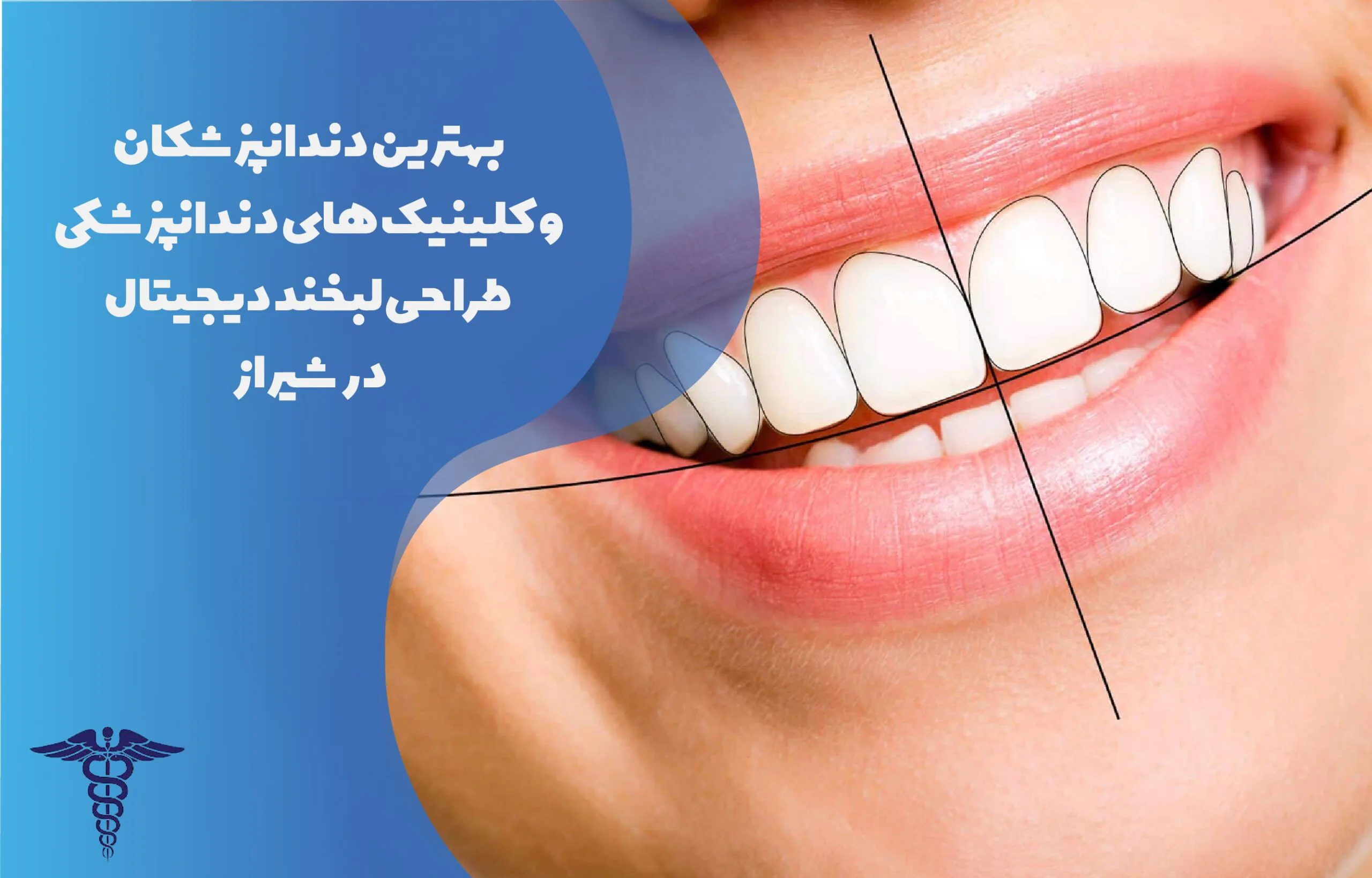 بهترین کلینیک ها و دندانپزشکان طراحی لبخند دیجیتال در شیراز