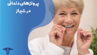 راهنمای جامع پروتزهای دندانی در شیراز