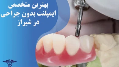 بهترین متخصص ایمپلنت بدون جراحی در شیراز