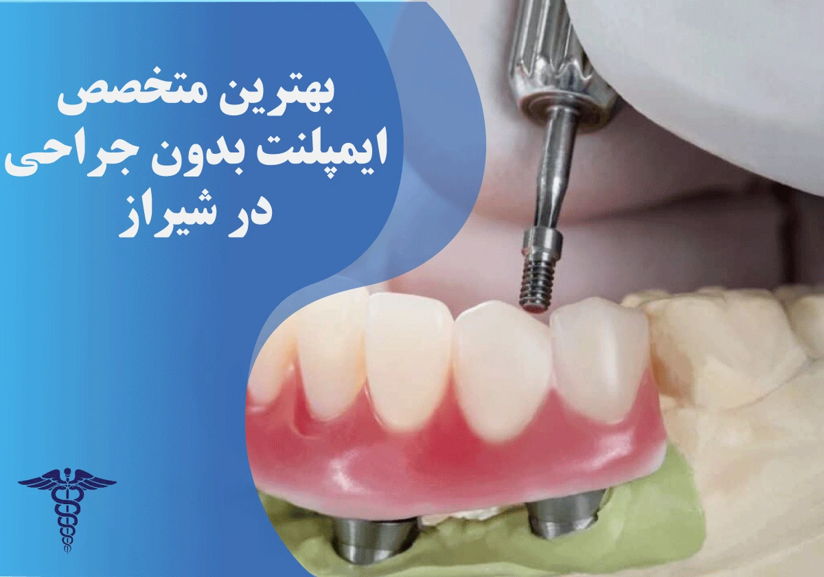 بهترین متخصص ایمپلنت بدون جراحی در شیراز