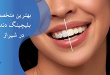لیست بهترین متخصص بلیچینگ دندان در شیراز