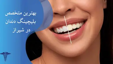 لیست بهترین متخصص بلیچینگ دندان در شیراز