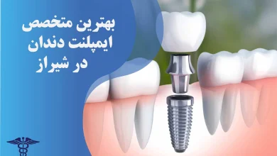 20 تا از بهترین جراح شکستگی فک در شیراز