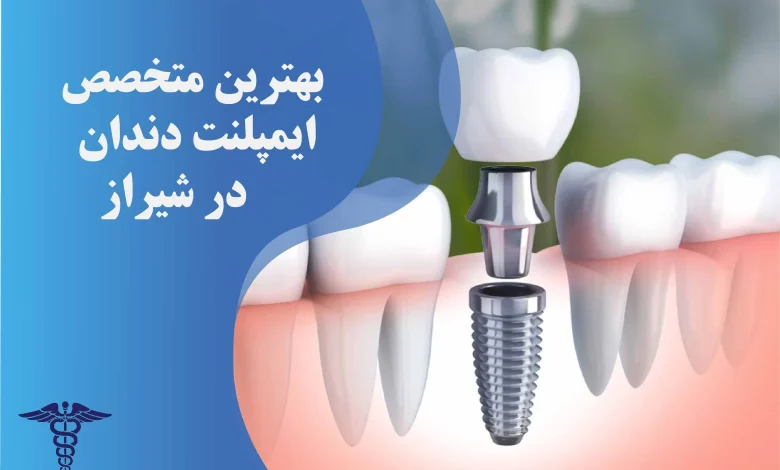 20 تا از بهترین جراح شکستگی فک در شیراز