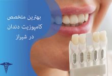 بهترین متخصص کامپوزیت دندان در شیراز