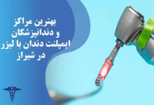 بهترین متخصص کامپوزیت دندان در شیراز