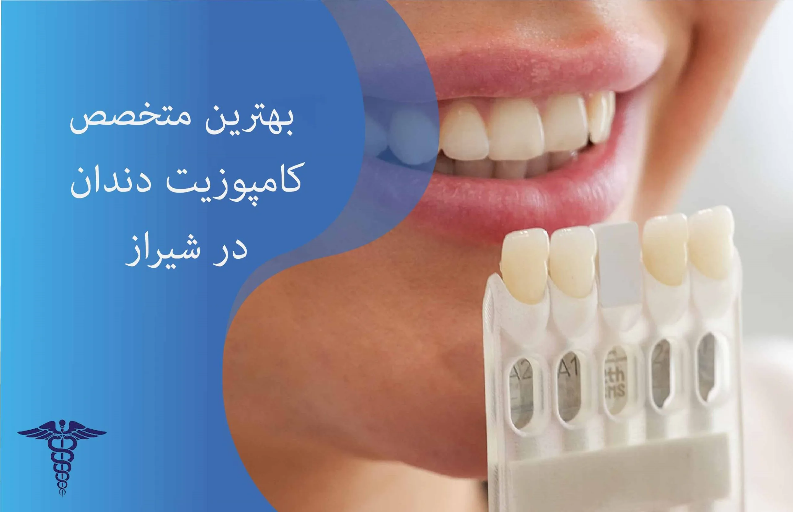 بهترین متخصص کامپوزیت دندان در شیراز