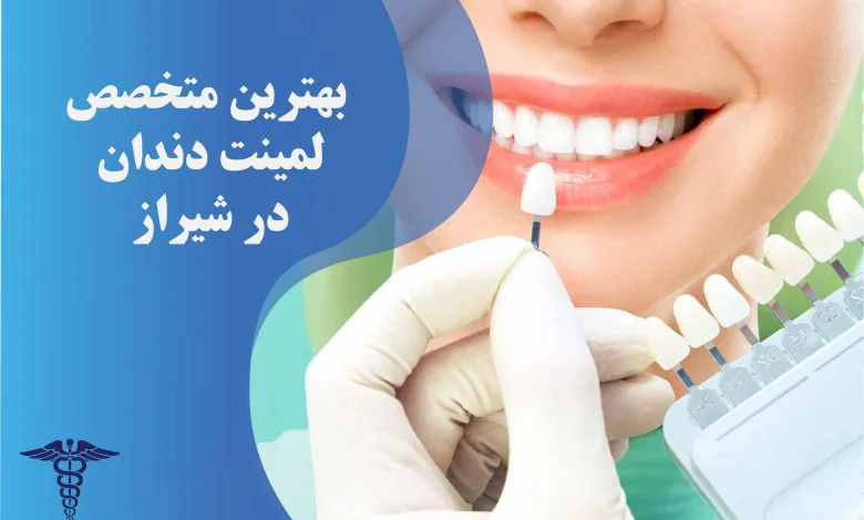 لیست بهترین متخصص لمینت دندان در شیراز