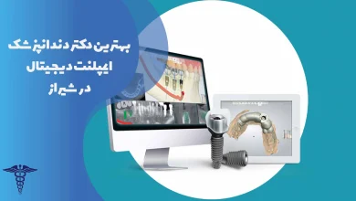 لیست بهترین دندانپزشکان ایمپلنت دیجیتال در شیراز