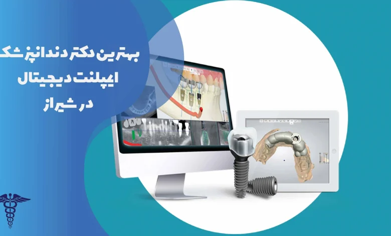 لیست بهترین دندانپزشکان ایمپلنت دیجیتال در شیراز