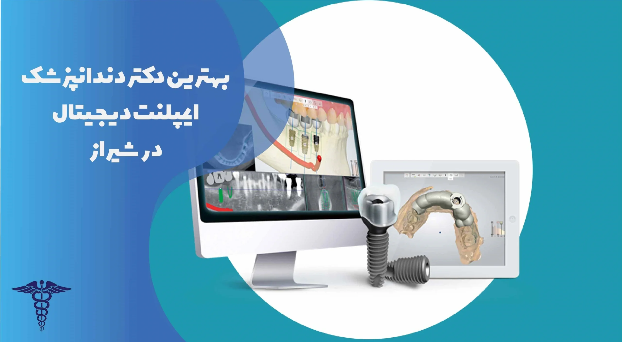 لیست بهترین دندانپزشکان ایمپلنت دیجیتال در شیراز