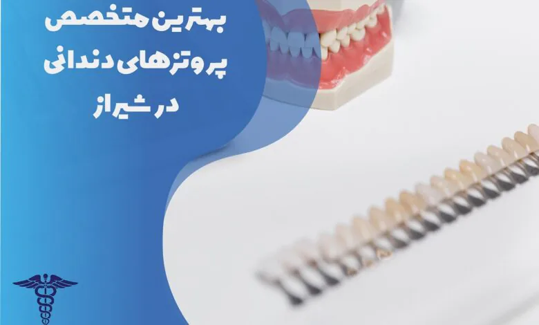 لیست بهترین متخصص پروتزهای دندانی در شیراز