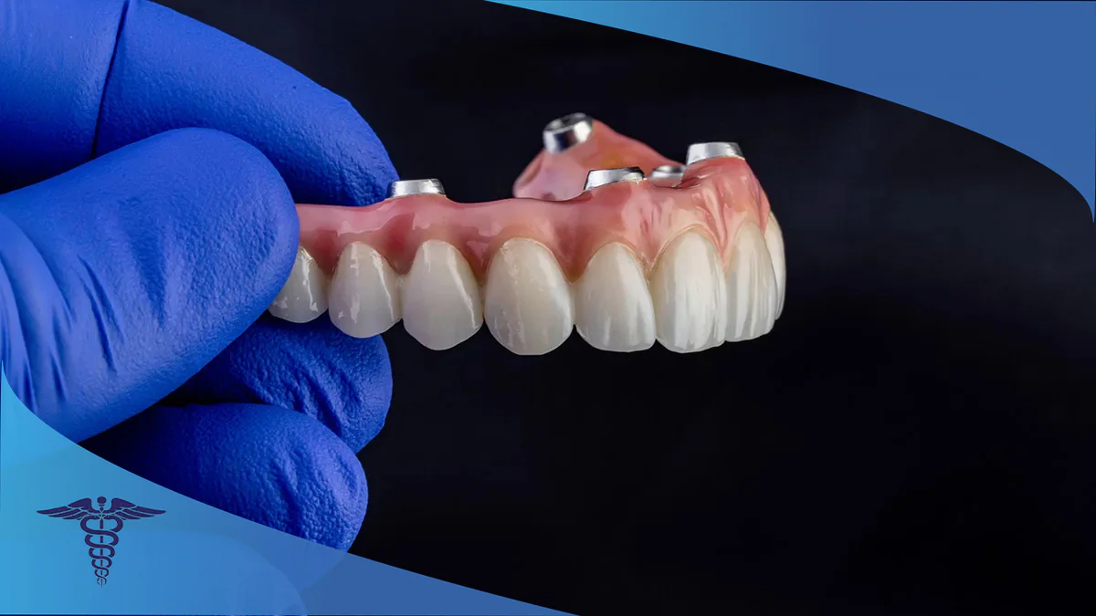 22 تا از بهترین متخصص اوردنچر شیراز
