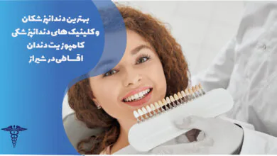 25 تا از بهترین کامپوزیت دندان اقساطی در شیراز