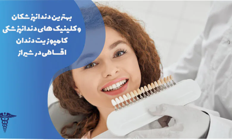 25 تا از بهترین کامپوزیت دندان اقساطی در شیراز