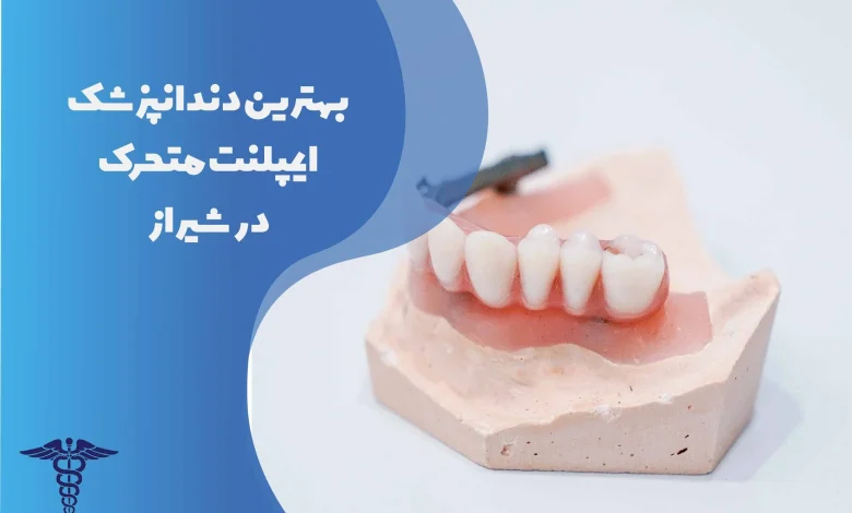 25 تا از بهترین دندانپزشک ایمپلنت متحرک در شیراز