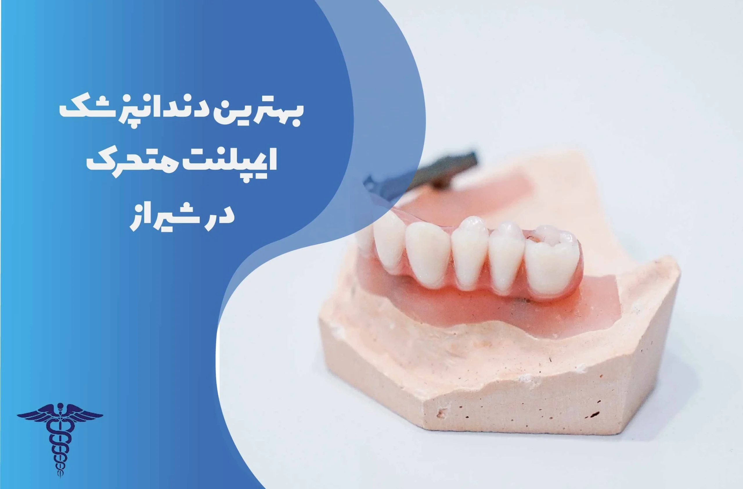 25 تا از بهترین دندانپزشک ایمپلنت متحرک در شیراز