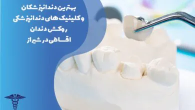 بهترین دندانپزشکان و کلینیک های روکش دندان اقساطی در شیراز