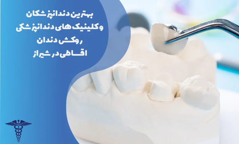 بهترین دندانپزشکان و کلینیک های روکش دندان اقساطی در شیراز