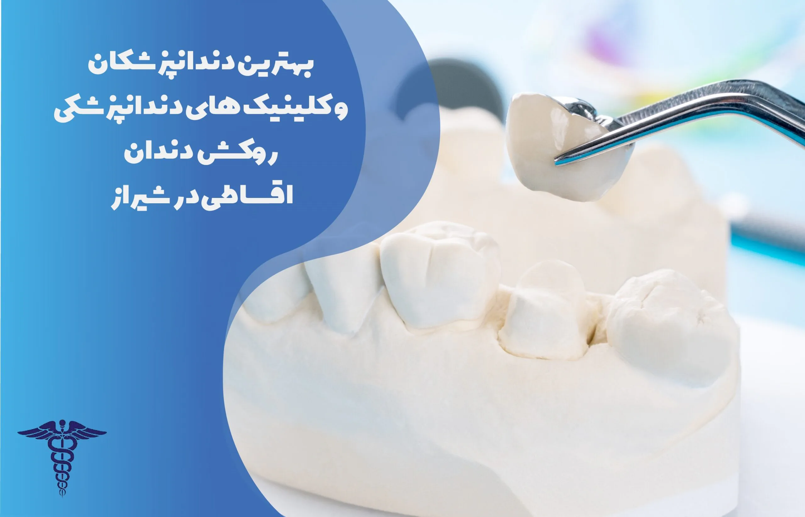 بهترین دندانپزشکان و کلینیک های روکش دندان اقساطی در شیراز