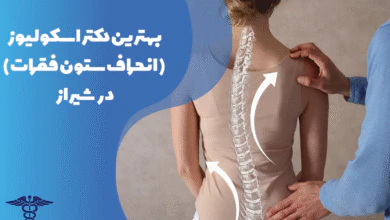 معرفی بهترین دکتر اسکولیوز در شیراز