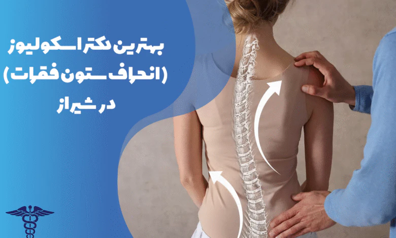 معرفی بهترین دکتر اسکولیوز در شیراز